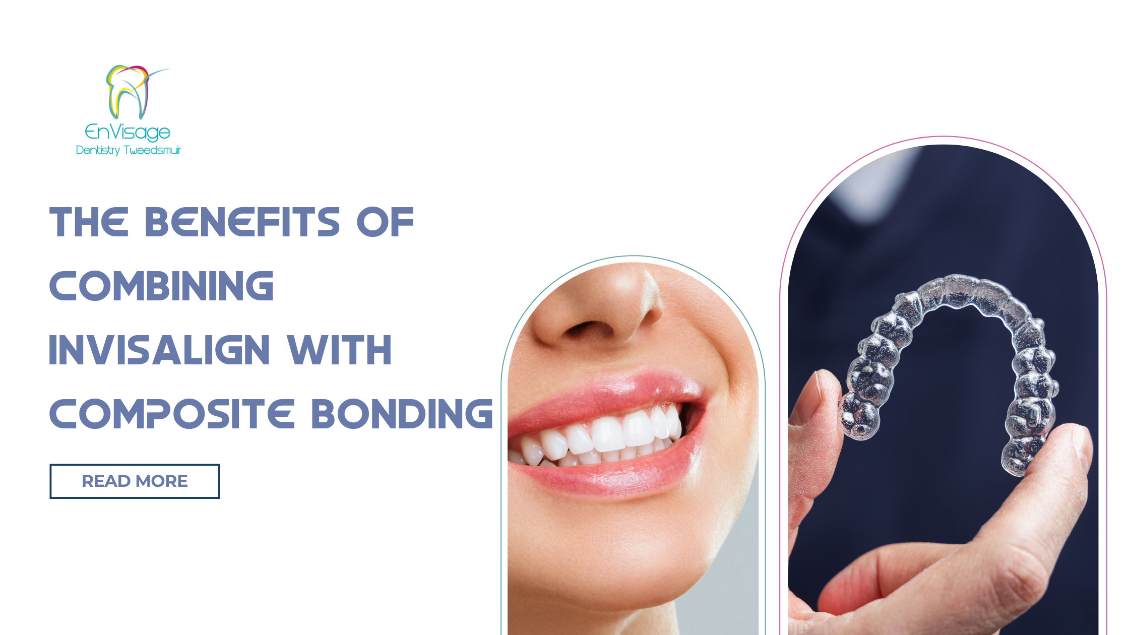 The Benefits of Combining Invisalign® with Composite Bonding